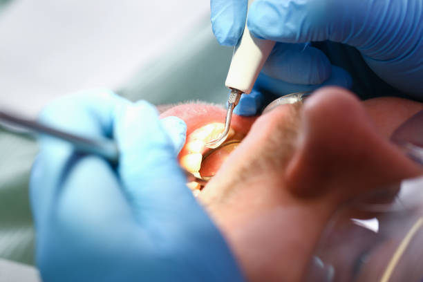 Best Emergency Dental Care for Broken or Chipped Teeth in Olathe, KS