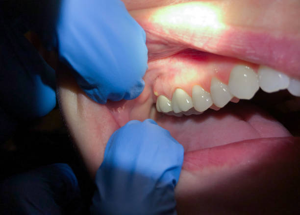Best Cosmetic Emergency Dentistry in Olathe, KS